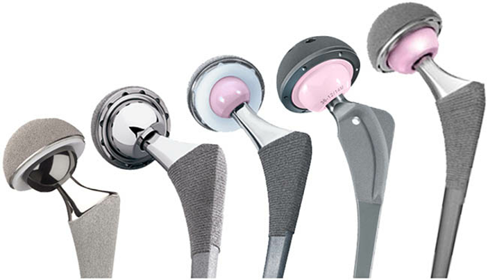 Виды имплантов суставов