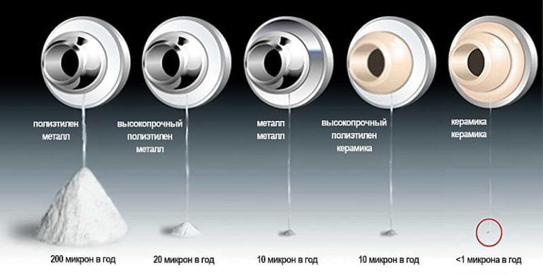 Скорость износа эндопротеза